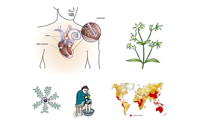 Illustrations pour livre de médecine